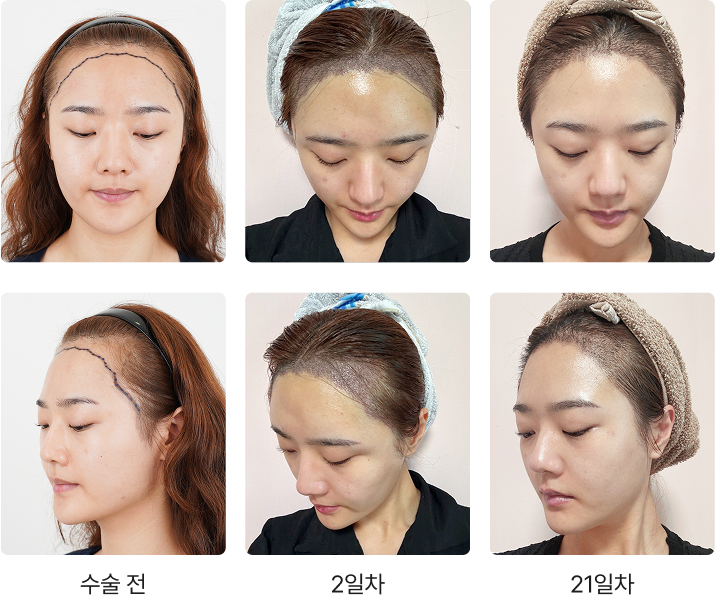 396일 간의 리얼 변화