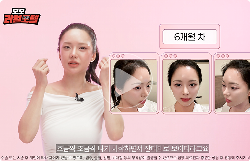 모모 리얼모델 썸네일3