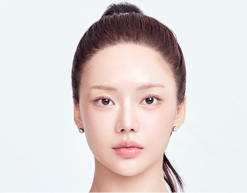 남성 절개 모발이식 after