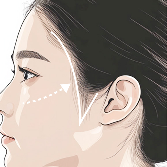 구레나룻2