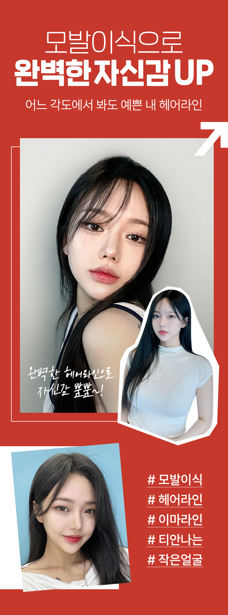 모발 이식으로 자신감 업!