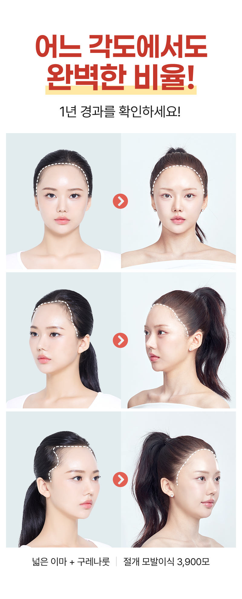 모델 전/후
