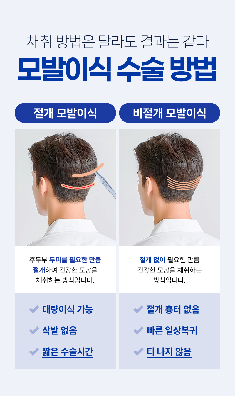 모발이식 수술 방법 - 절개, 비절개