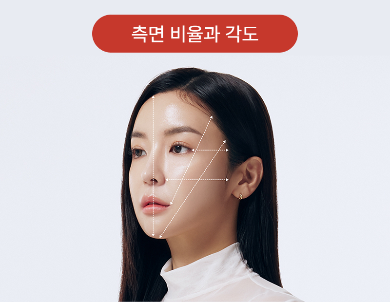 여성 모발이식 구레나룻 디자인