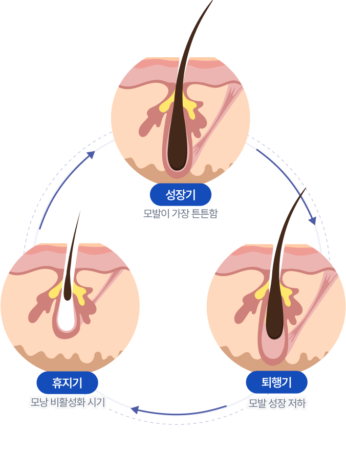성장기 모발이 레이저 제모 시술에
더 잘 반응합니다